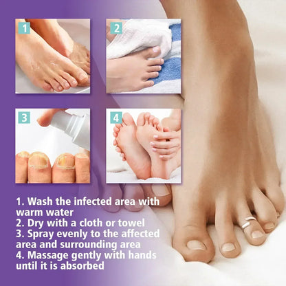 Jaysuin - Nail Fungus Spray