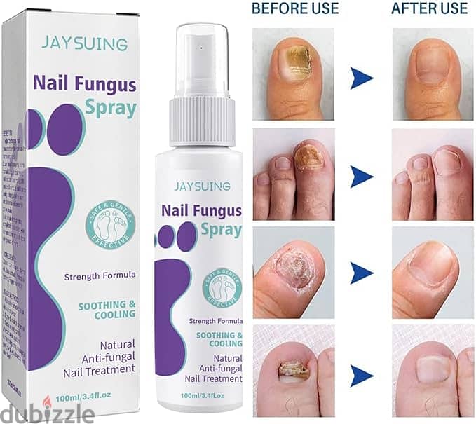 Jaysuin - Nail Fungus Spray